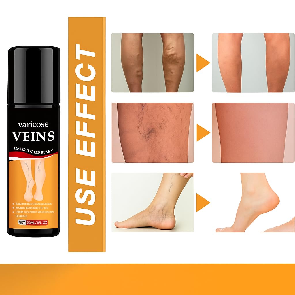 Turmeric Varicose Veins Relief Spray 🌿