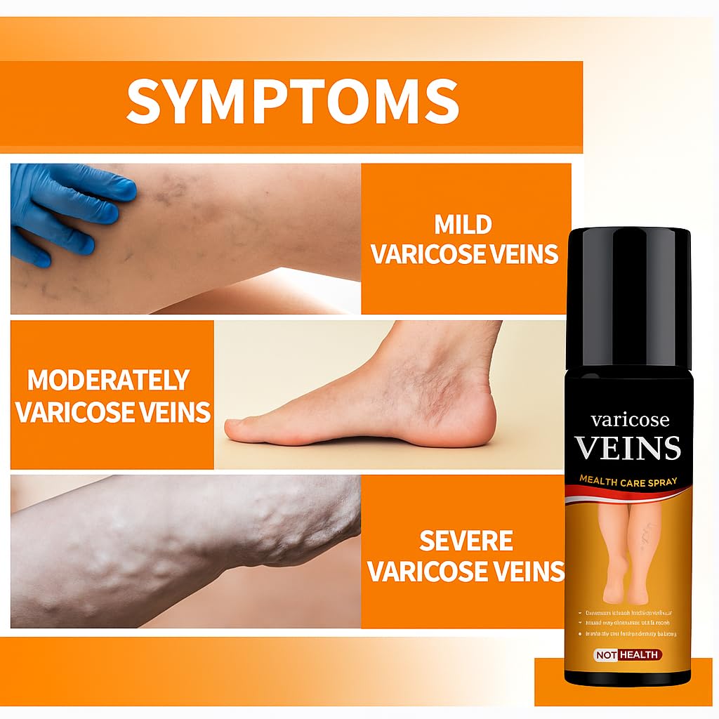 Turmeric Varicose Veins Relief Spray 🌿