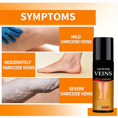 Turmeric Varicose Veins Relief Spray 🌿