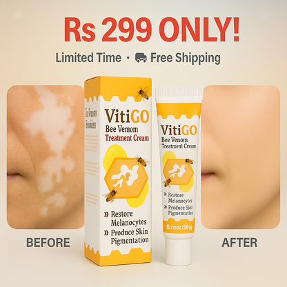 VitiGO™ Bee Venom Corrector Cream
