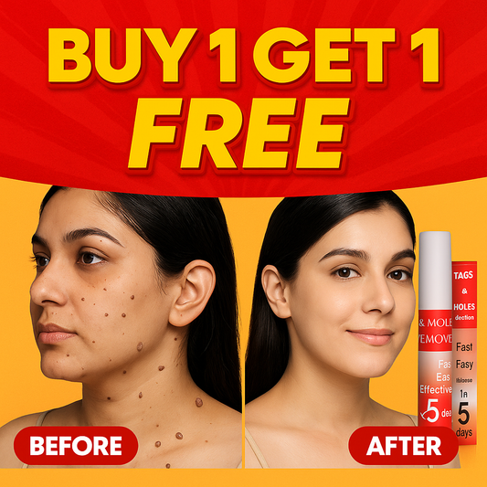 LOVILDS™ Warts & Tags Remover (Buy 1 Get 1 FREE🔥🔥)