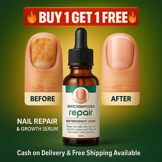 Nail Repair & Growth Serum Spray - 🔥BUY 1 GET 1 FREE🔥