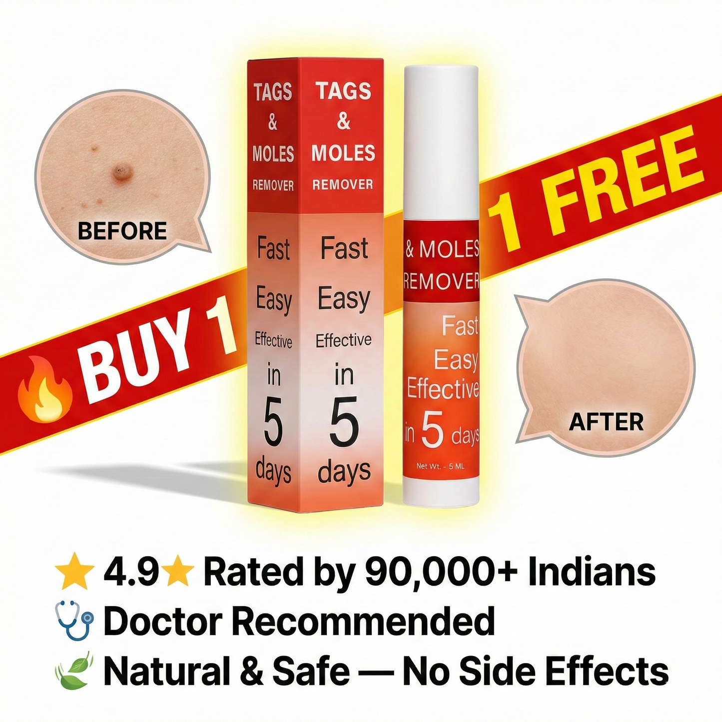 LOVILDS™ Warts & Tags Remover (Buy 1 Get 1 Free🔥🔥)
