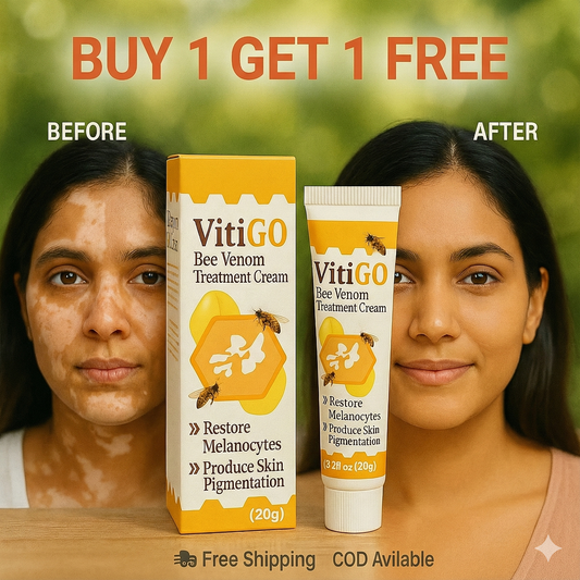 VitiGO™ - Vitiligo தீர்வு (1+1 FREE) 🔥