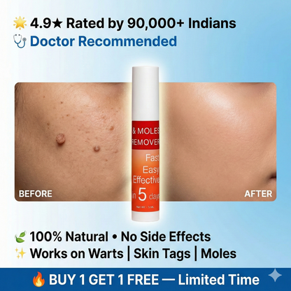LOVILDS™ Warts & Tags Remover (Buy 1 Get 1 Free🔥🔥)
