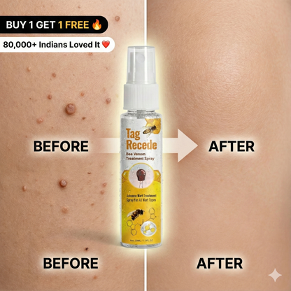 Wart & Maru (Skin Tag) Remover Spray - Buy 1 Get 1 FREE