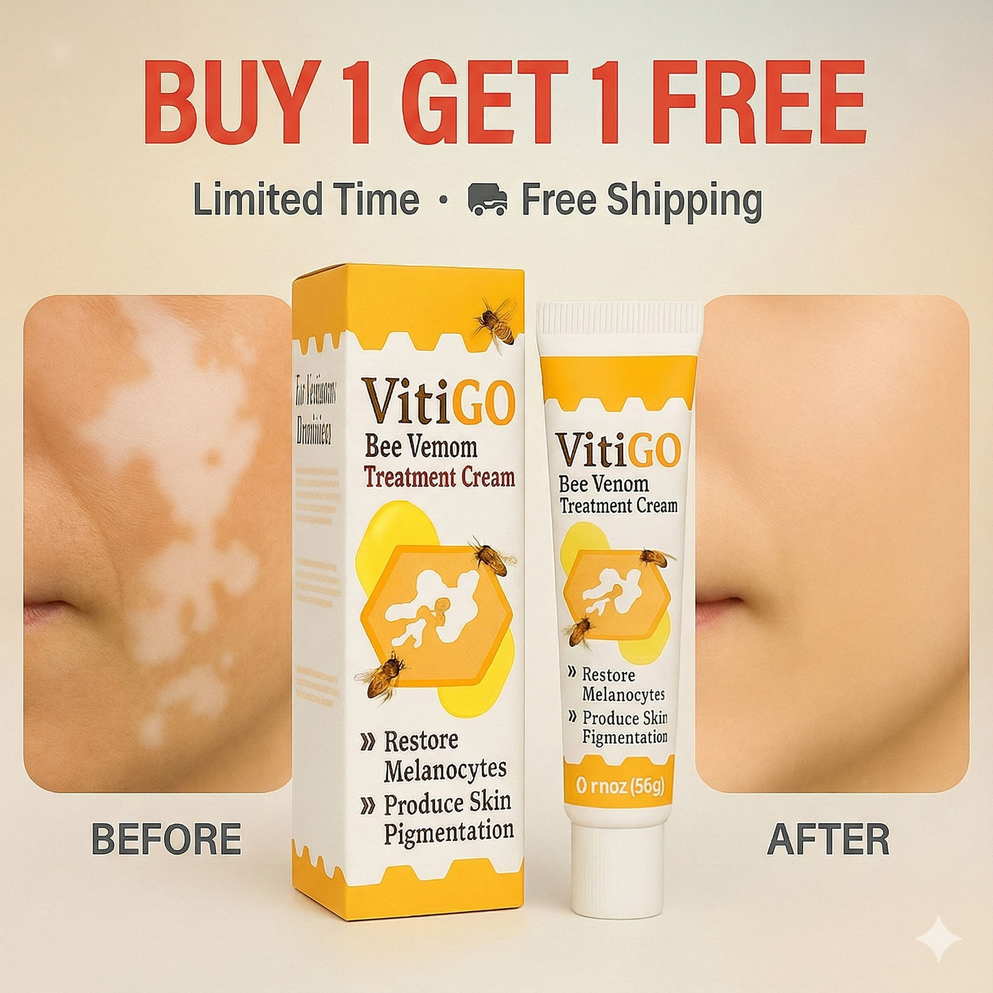 VitiGO™ - Vitiligo தீர்வு (1+1 FREE) 🔥