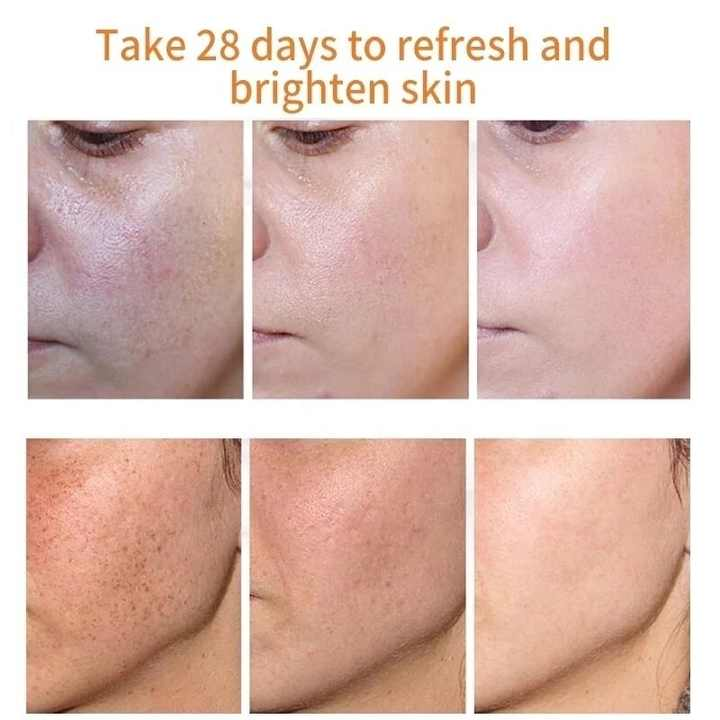 MOOYAM Korean Whitening & Melasma Cream- (Buy 1 Get 1 FREE)