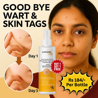Wart & Skin Tags Remover Spray -  (Buy 1 Get 1 FREE🔥🔥)