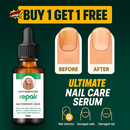 Nail Repair & Growth Serum Spray - 🔥BUY 1 GET 1 FREE🔥
