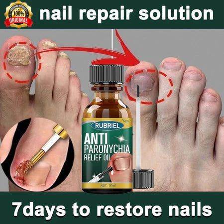 Anti Paronychia Relief Oil 🌿 - (Buy 1 Get 1 FREE🔥🔥)