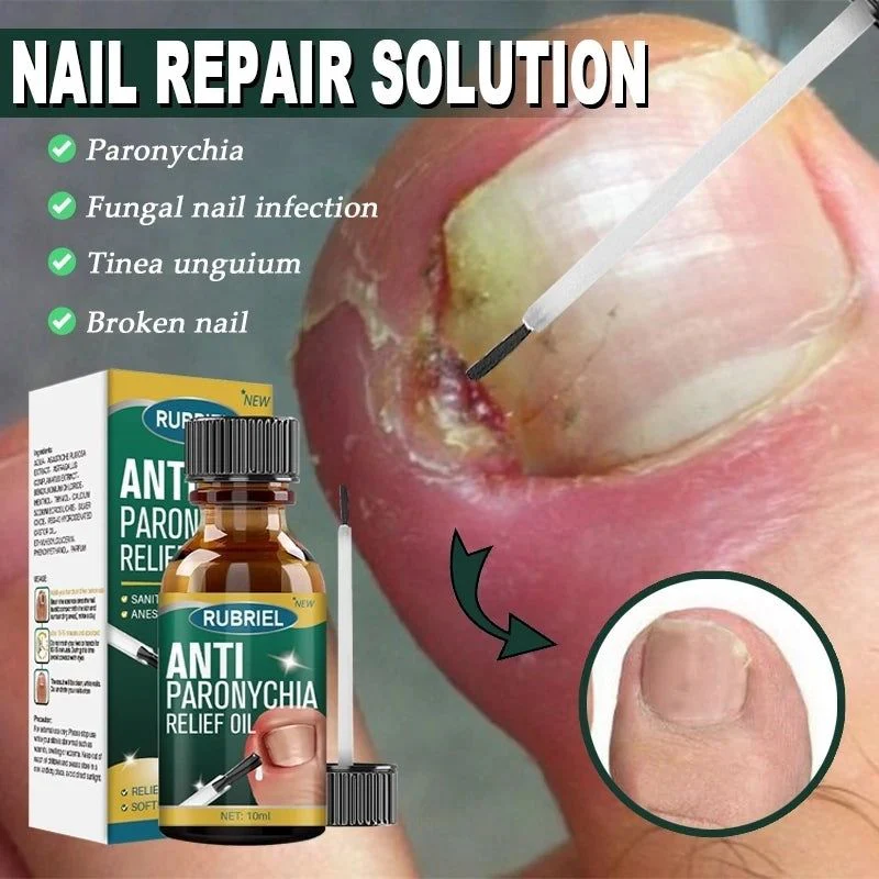 Anti Paronychia Relief Oil 🌿 - (Buy 1 Get 1 FREE🔥🔥)