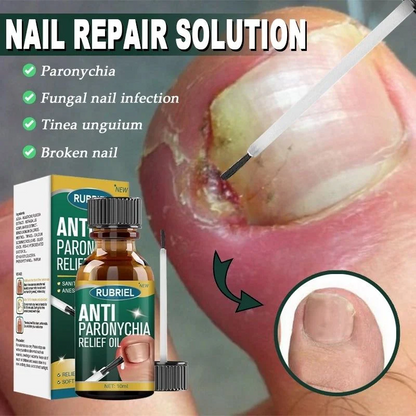 Anti Paronychia Relief Oil 🌿 - (Buy 1 Get 1 FREE🔥🔥)