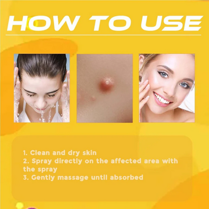 Bee Venom Wart & Skin Tag Remover Spray